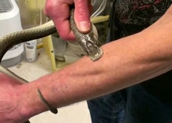 the person bitten by poisonous snake can survive 69570