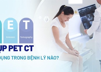 the process of taking pet ct when to apply it in which disease 135008