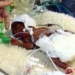 the time between two pregnancies affects newborn health 4946