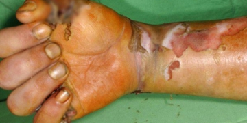 the truth about drugs that can destroy the body is more frightening than crack 64797
