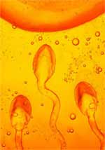 Low sperm counts are contributing factors to the rising number of infertility cases.