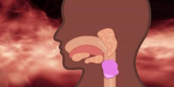 what happens when you swallow gummy candy 73072