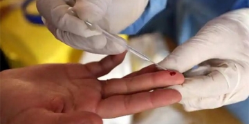 who detected 3 dangerous cancer diseases with just a drop of dry blood 134051