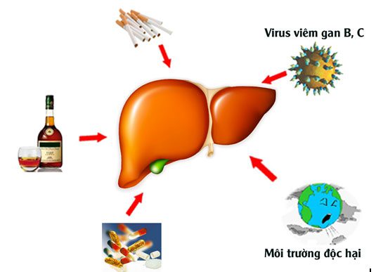 Causes of cirrhosis