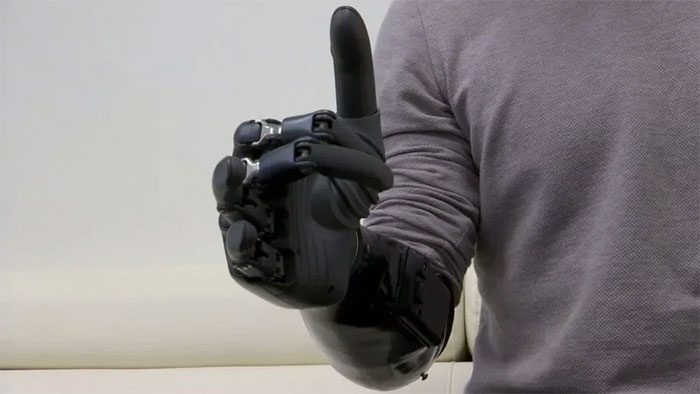 Bio-robotic arm