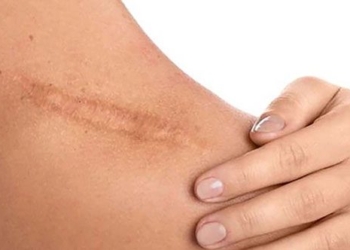 cat care wound help reduce itching 131635