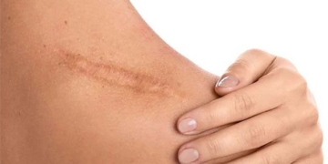 cat care wound help reduce itching 131635