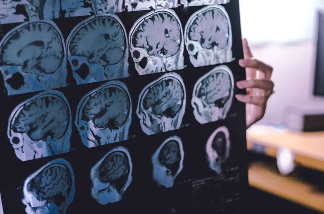 Increased memory loss in those who sit more than 10 hours and are sedentary.