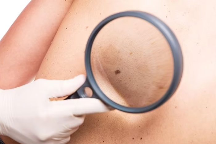 Using low-frequency terahertz radiation can detect skin cancer early.