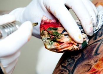 flower turns gray in the immune cells of the skin why do they appear like this 131574