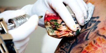 flower turns gray in the immune cells of the skin why do they appear like this 131574