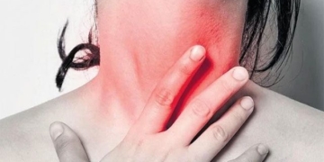 hot pink rash very painful 131681