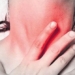 hot pink rash very painful 131681