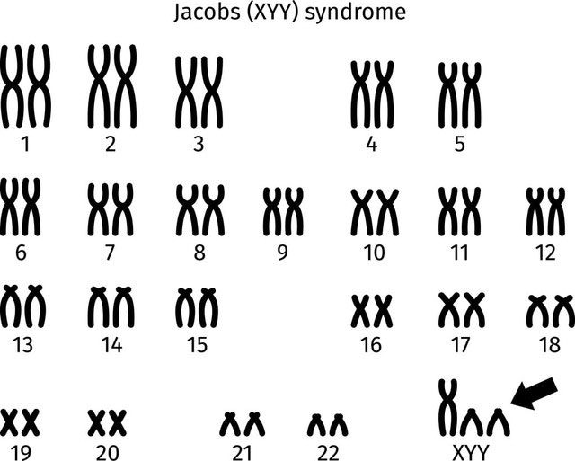 Superman Syndrome in the medical community is officially referred to as XYY syndrome.