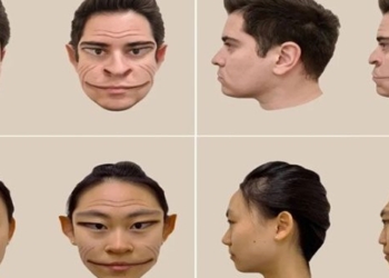 rare syndrome makes people see demons 133404