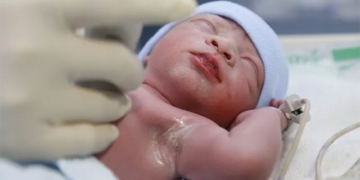 the first baby in vietnam to be operated on while still in mothers womb 132458