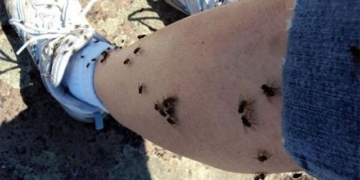 the surprising reason why flies like to bite people even if they dont draw blood or eat flesh 132208