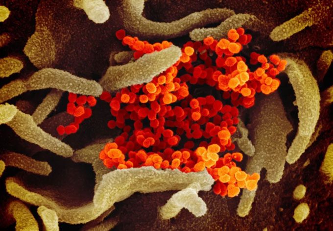 Electron microscope image of nCoV, orange.