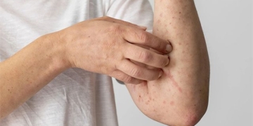 warning signs of parasitic infection 132479