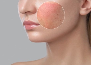 why does the throat often get irritated when exposed to the wind 10 measures to quickly reduce symptoms 131516