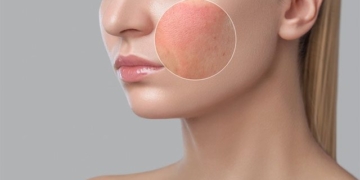 why does the throat often get irritated when exposed to the wind 10 measures to quickly reduce symptoms 131516