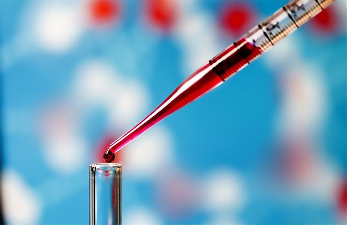 Blood test for Alzheimer’s developed by the HKUST team is very simple and effective.