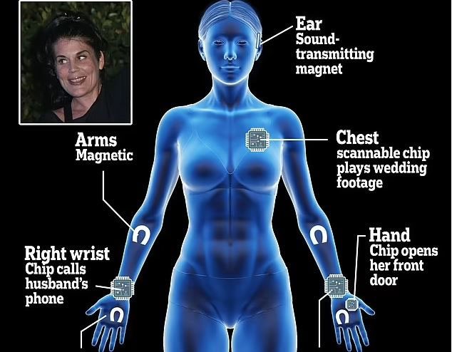 Placement of some magnetic devices and chips on Mrs. Synn's body.