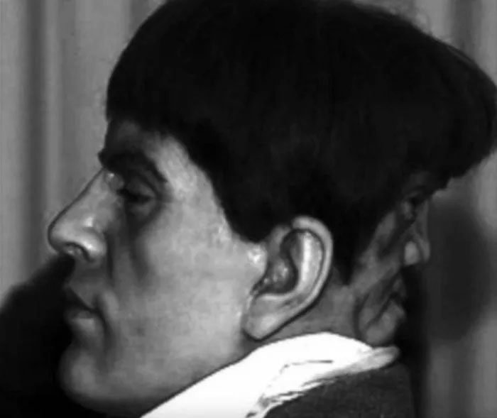 Wax statue depicting Edward Mordrake.