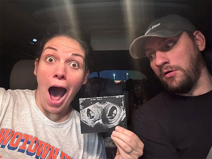 Ms. Kelsey Hatcher shows an ultrasound image of the two fetuses in her womb to her husband Caleb on May 23