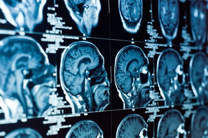 Brain components responsible for this are the inferior cortex.