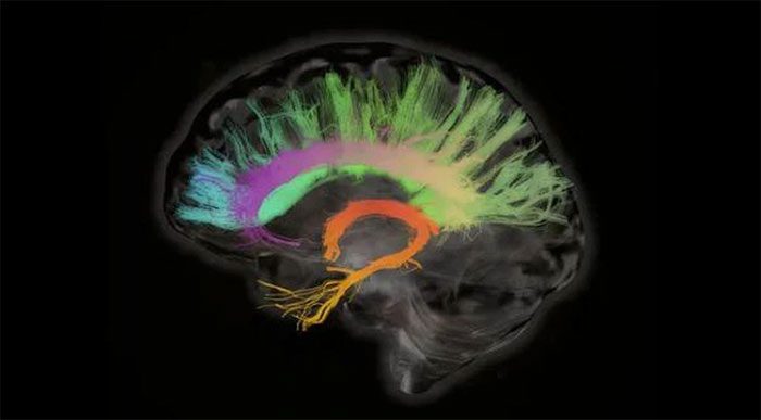 Colorful X-ray image of the human brain