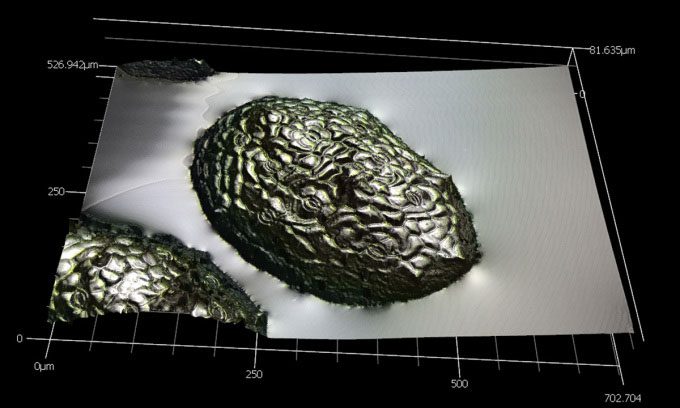 Laser scanning microscope image of watermeal after exposure to hypergravity.