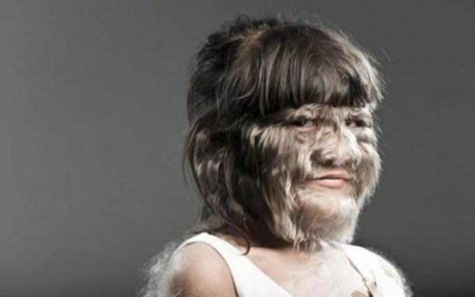 Natty is referred to as "the wolf girl."