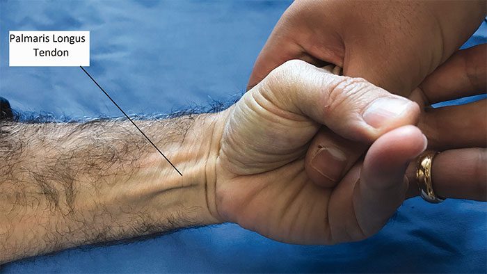 In humans, over time, this muscle has degenerated to the point that having it or not doesn't matter.