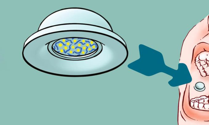 The suction cup temporarily adheres medication to the inner lining of the cheek.