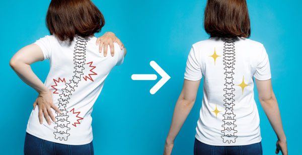 Scoliosis