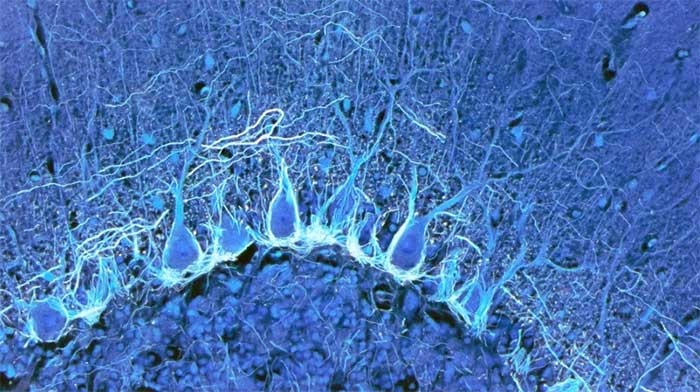 Purkinje cells, large neurons in the cerebellum