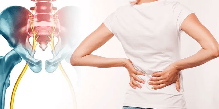 Sciatica can occur almost anywhere along the nerve pathway.