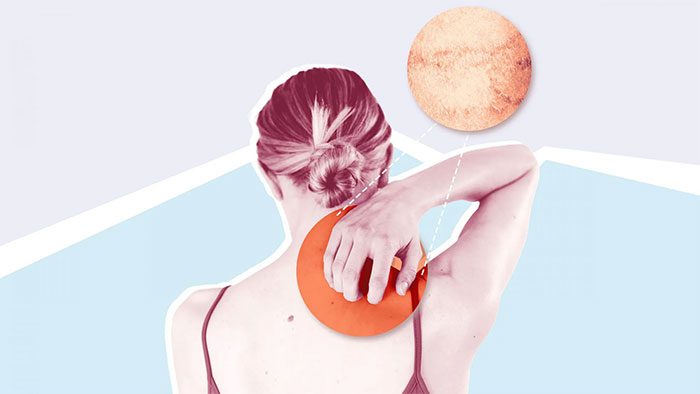 Allergy is a very common immune response of the body.