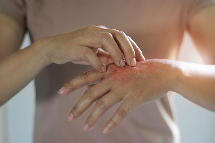 Some daily habits can also help reduce allergy symptoms.