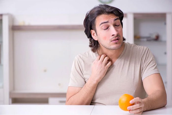 Citrus allergy symptoms often start with oral allergy signs.