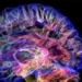 electrical stimulation therapy help 5 people recover after brain injury 131492