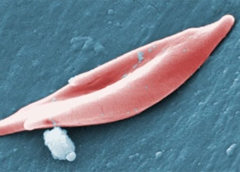 first genetic editing drug approved in the world 131082