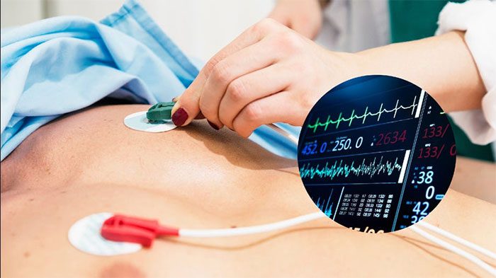 Myocardial infarction is a dangerous cardiovascular condition with a high mortality rate.