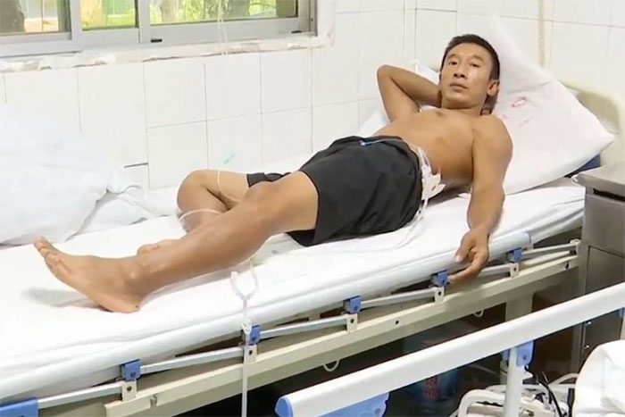 Liu Nan survived after being struck by lightning twice.