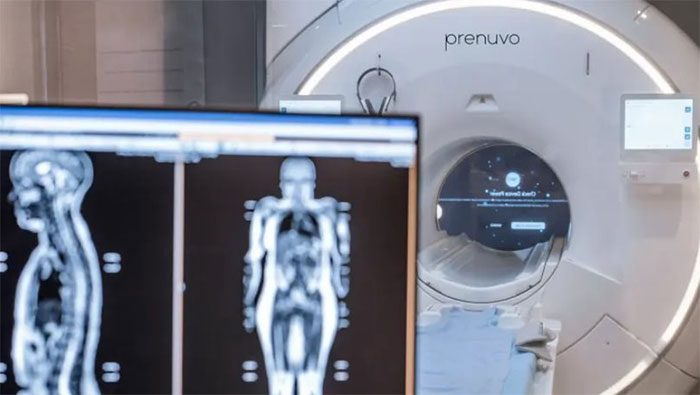 Full-body MRI at Prenuvo.