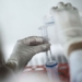 new discovery on how cancer cells resist standard chemotherapy 130595