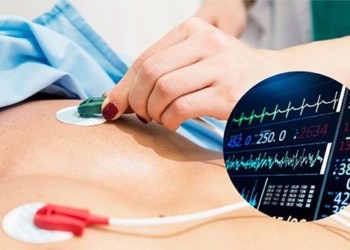 new method to quickly diagnose acute myocardial infarction 130518