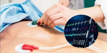 new method to quickly diagnose acute myocardial infarction 130518
