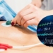 new method to quickly diagnose acute myocardial infarction 130518